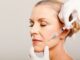 Антивозрастное лечение ботоксом с использованием вытяжки и других приспособлений: ваш ответ на старение кожи, описание