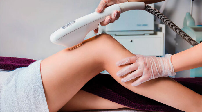 Плюсы лазерной эпиляции — как подготовиться к процедуре