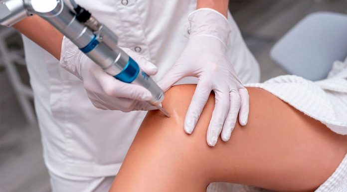 Что нужно знать о лазерной шлифовке тела: как работает лазерная шлифовка тела