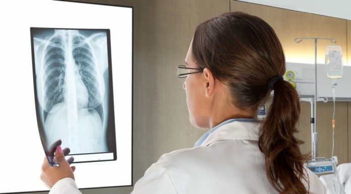 Как происходит процесс рентгена?