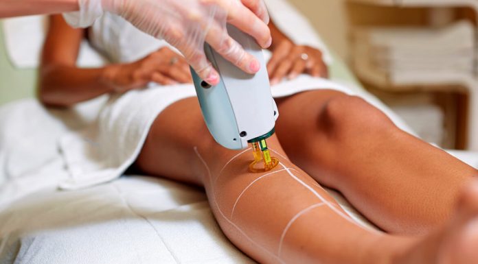 Удаление волос лазерной эпиляцией: плюсы и достоинства метода