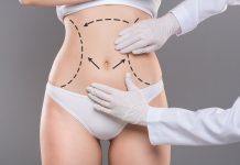 Липосакция: получаем отличное тело без трудностей