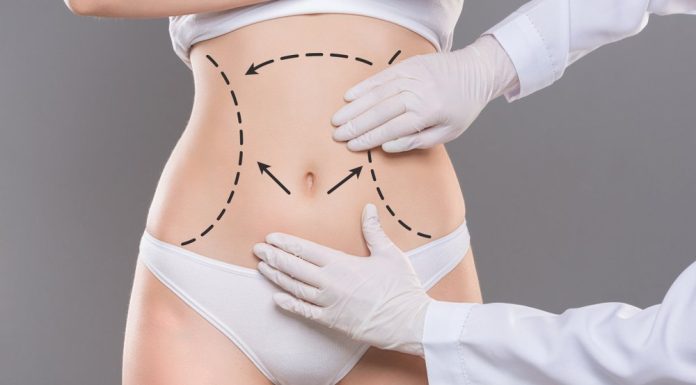 Липосакция: получаем отличное тело без трудностей