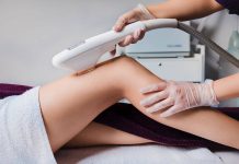 Лазерная эпиляция: современный метод удаления нежелательных волос
