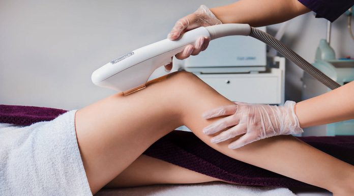 Лазерная эпиляция: современный метод удаления нежелательных волос