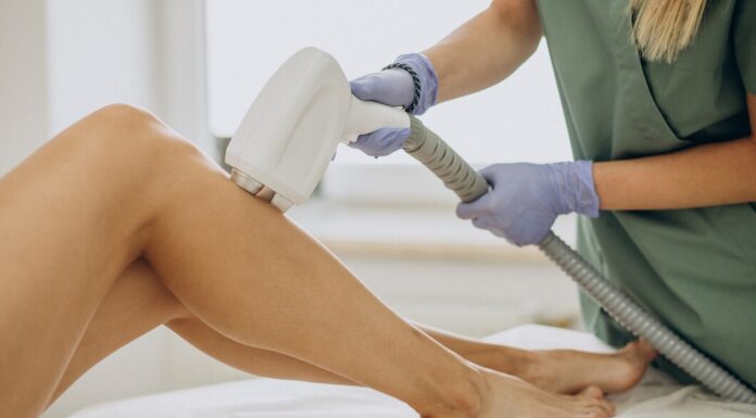 Лазерная эпиляция ног: подробное руководство