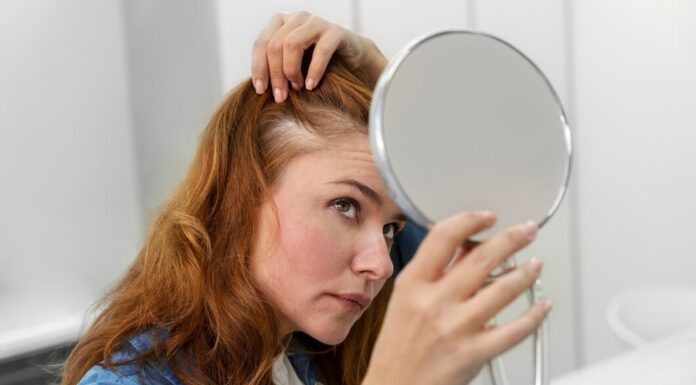 Алопеция: когда волосы начинают уходить раньше времени