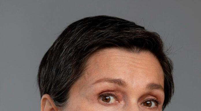 Почему появляются морщины на лице и как с ними бороться