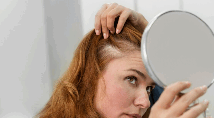 Лечение алопеции: современные методы и подходы к восстановлению волос